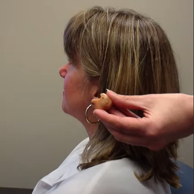 How to insert an in-the-ear hearing aid